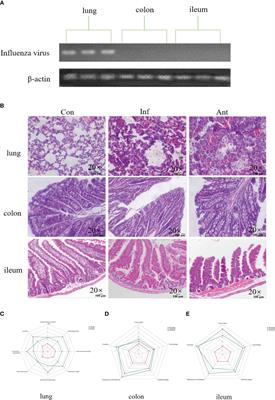 Signals from intestinal microbiota mediate the crosstalk between the lung-gut axis in an influenza infection mouse model